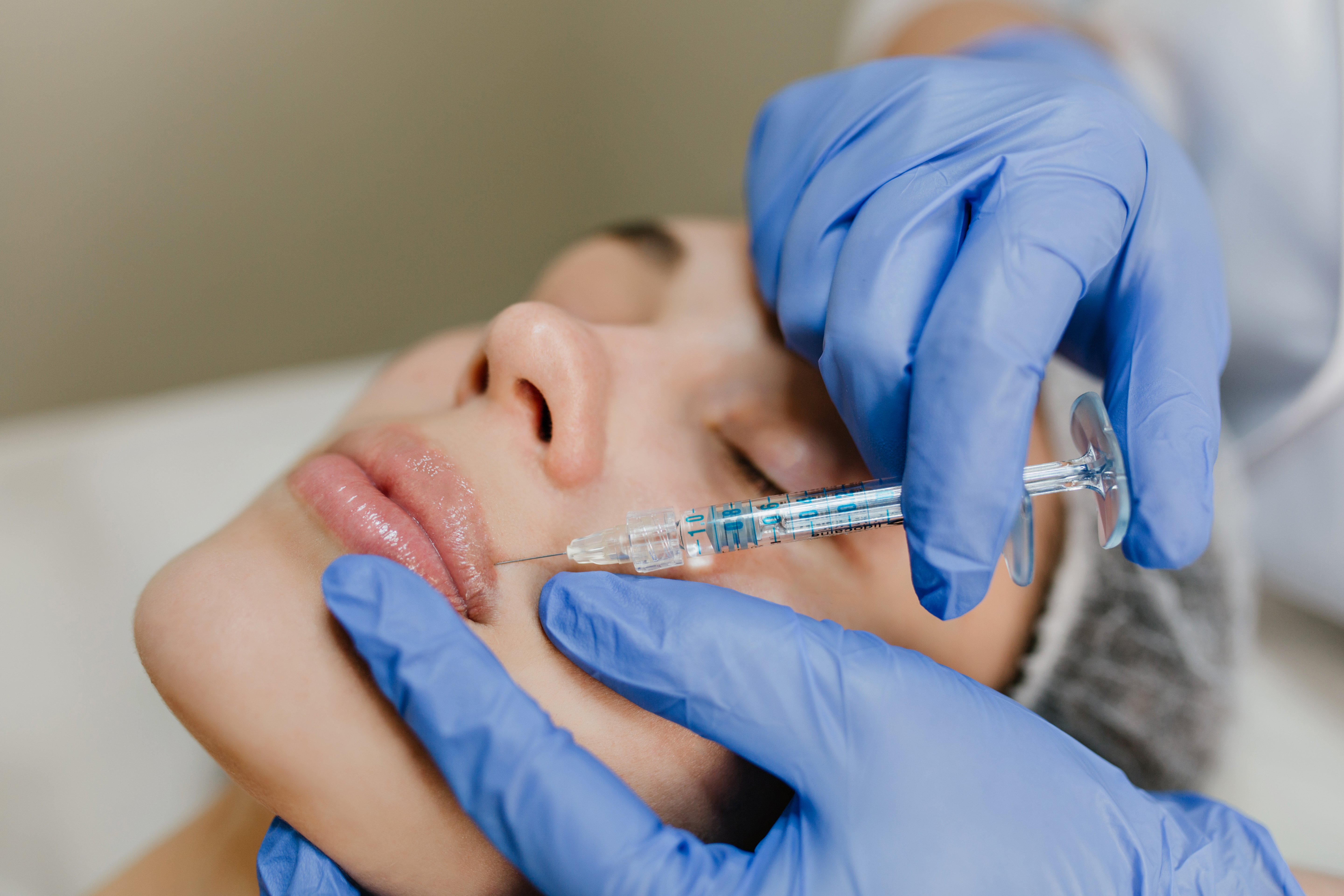 Dermal Fillers